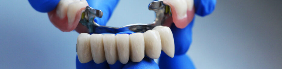 how to care for your dental bridge