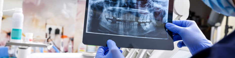 how can a tooth infection be identified in an x ray