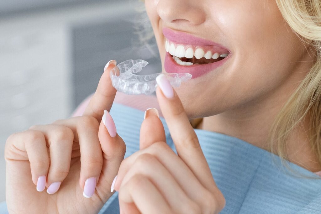 What should I know about clear aligners?